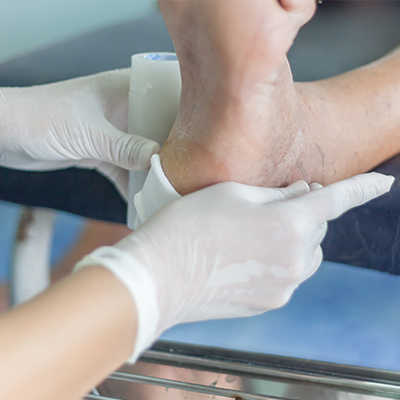Diabetic Foot Care